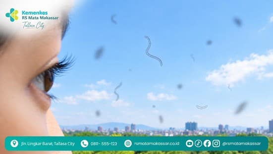 Melihat Bintik atau Bayangan yang Melayang? Ini Penyebab Floaters pada Mata